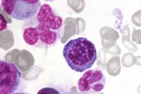 Moelle osseuse humaine cellules en mitose - mprophase x400